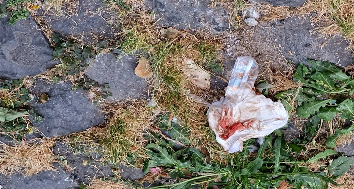 Accoltellato per difendere la fidanzata